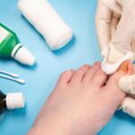 Corn Removal Specialist in London Ontario | Gentle, Expert Foot Care