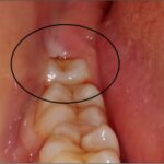 A Smile’s Secret: A Gentle Transformation in Rajkot