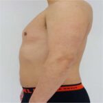 Mounjaro Price Malaysia: Safe, MOH‑Approved Treatments