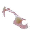 Immediate Dentures Cost: What to Expect and How to Save