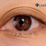 How to Cure Pterygium: Practical Tips and Care