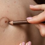 Surgery Scar Camouflage in Dubai — Expert, Natural Results