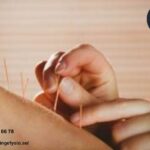 Akupunktur Haninge | Haningefysio.se