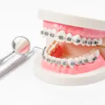 Understanding Orthodontics Cost: Clear, Honest Pricing