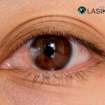 Eye Surgery Pterygium Removal: Trusted Houston Experts