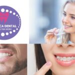 Blanqueamiento Dental Gines – Sorris Brillant amb Clinicadentalcristinamora