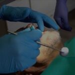 Emergency Dentist Newmarket Ontario | Fast, Gentle Care