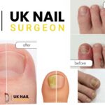 Kids’ ingrown toenails: gentle relief and care tips