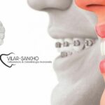 Clínica Vilar Dental Pozuelo: cuidado dental de confianza