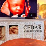 3D/4D Fetal Imaging Perth | Cedar 4D Ultrasound