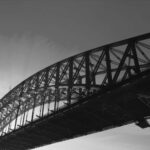 Gum Recession Treatment in Columbia SC | Gentle, Effective Care