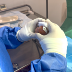 Ingrown Toenail Birmingham: Expert Care for Quick Relief
